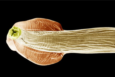 Round Worm (Ascaris lumbricoides) - Respiratory System